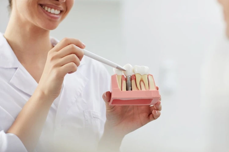 Dental implants in Port Coquitlam at Shaughnessy Square Dental Centre