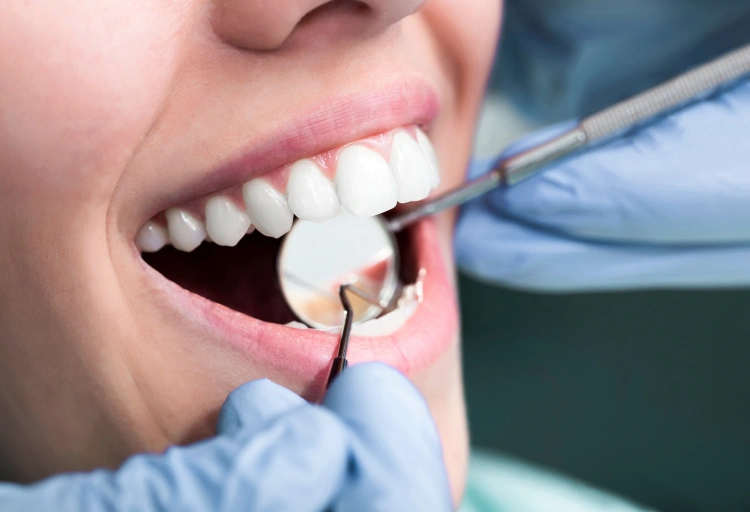 Tooth extraction in Port Coquitlam at Shaughnessy Square Dental Centre